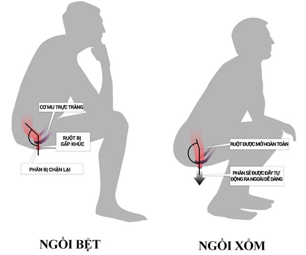 Ưu điểm đặc biệt về sức khỏe của bồn cầu ngồi xổm